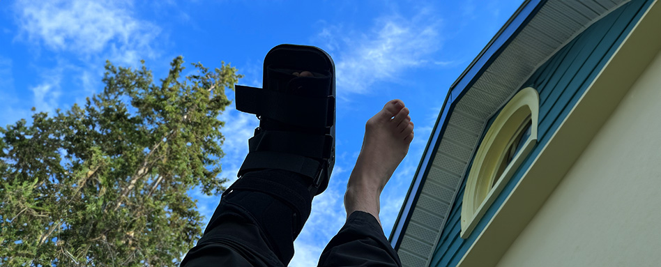 randonnée avec un pied cassé